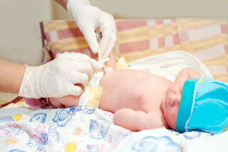 Процедуры ухода за пупком новорожденного